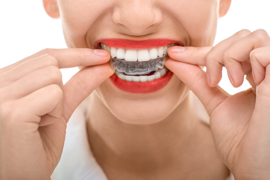 Closeup of a woman with red lipstick putting in her Invisalign tray