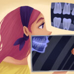 Illustration of a woman's side profile as she gets digital dental X-rays of her teeth