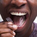 how Invisalign works, Invisalign treatment process, ADC Dental Group, Dr. John C. Durling II, Joplin MO orthodontist