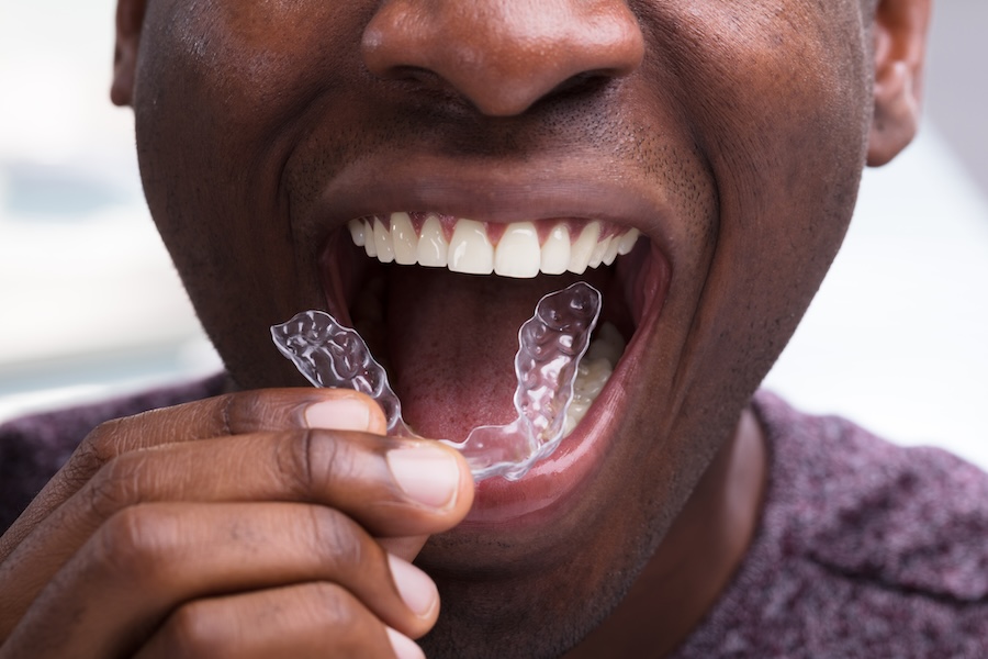 how Invisalign works, Invisalign treatment process, ADC Dental Group, Dr. John C. Durling II, Joplin MO orthodontist